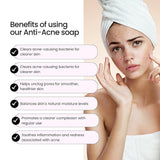 Samskrithi Naturals Anti Acne Face Soap Bar For Remove Acne Blemishes, Scars, Pimples, Dark Spots | Pack of 2x50g |Clear and Radiant Skin | for All Skin Types