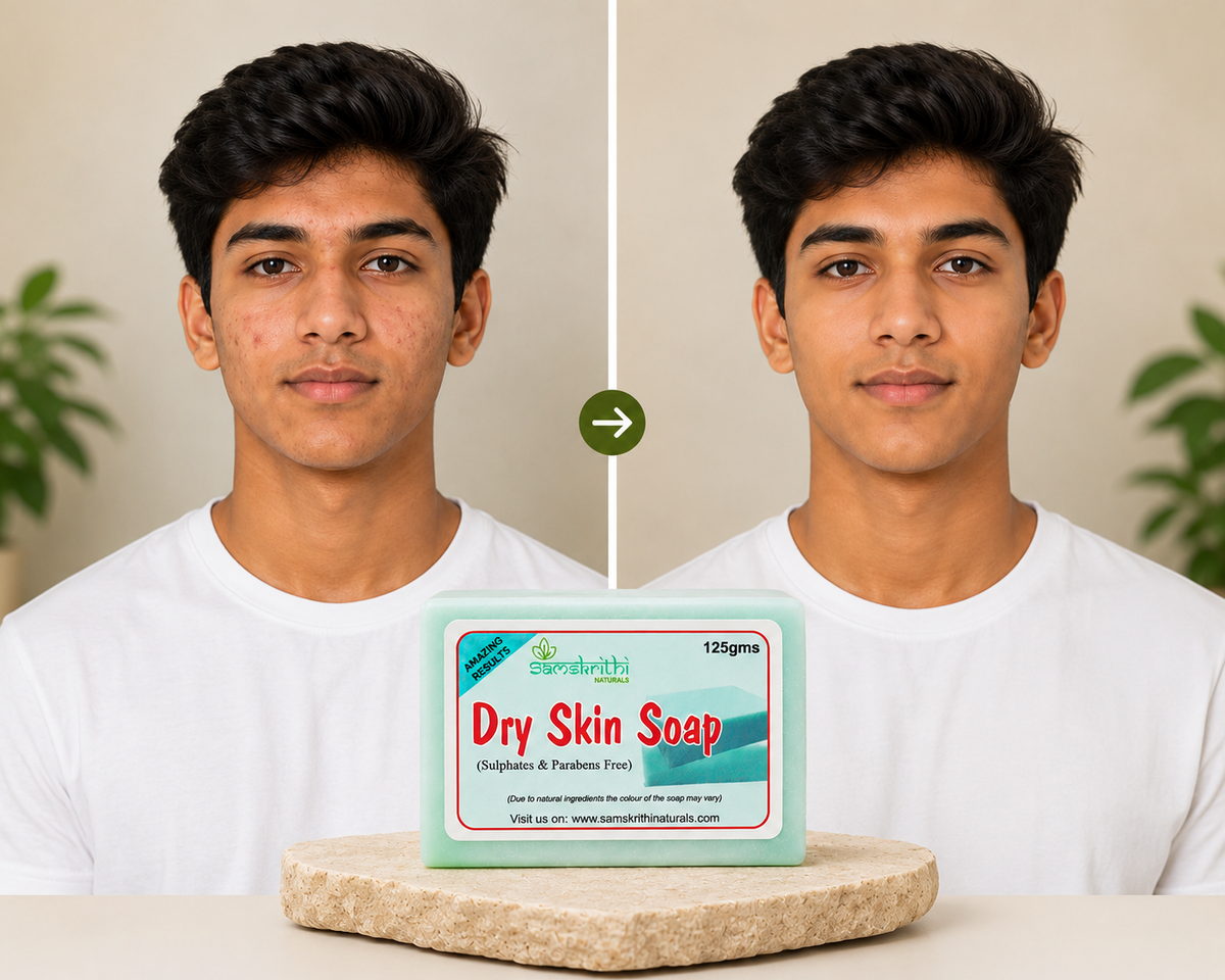 Samskrithi Naturals Dry Skin Soap