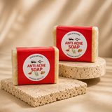 Samskrithi Naturals Anti Acne Face Soap Bar For Remove Acne Blemishes, Scars, Pimples, Dark Spots | Pack of 2x50g |Clear and Radiant Skin | for All Skin Types